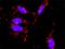 Signal Transducer And Activator Of Transcription 5A antibody, H00006776-M02, Novus Biologicals, Proximity Ligation Assay image 