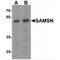 SAM Domain, SH3 Domain And Nuclear Localization Signals 1 antibody, MBS153721, MyBioSource, Western Blot image 