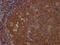 Inositol Polyphosphate-5-Phosphatase D antibody, CSB-RA157463A0HU, Cusabio, Immunohistochemistry paraffin image 