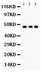 Solute Carrier Family 2 Member 2 antibody, PB9436, Boster Biological Technology, Western Blot image 