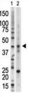 VRK Serine/Threonine Kinase 1 antibody, abx033380, Abbexa, Western Blot image 