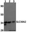 Solute Carrier Family 30 Member 2 antibody, A06643, Boster Biological Technology, Western Blot image 