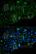 Hexokinase 2 antibody, A0994, ABclonal Technology, Immunofluorescence image 