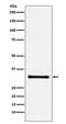 Complement C1q Binding Protein antibody, M01439, Boster Biological Technology, Western Blot image 
