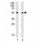 Aldehyde Dehydrogenase 1 Family Member A1 antibody, F44050-0.4ML, NSJ Bioreagents, Immunofluorescence image 