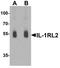 Interleukin 1 Receptor Like 2 antibody, A09203, Boster Biological Technology, Western Blot image 