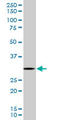 Ribosomal Protein S3 antibody, LS-C198118, Lifespan Biosciences, Western Blot image 