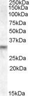 Prune Homolog 2 With BCH Domain antibody, NB100-93446, Novus Biologicals, Western Blot image 