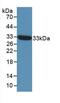 Suppression Of Tumorigenicity 14 antibody, MBS2001331, MyBioSource, Western Blot image 