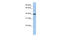 Pellino E3 Ubiquitin Protein Ligase Family Member 3 antibody, 26-888, ProSci, Western Blot image 