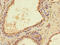 Pentatricopeptide Repeat Domain 2 antibody, CSB-PA823887LA01HU, Cusabio, Immunohistochemistry paraffin image 