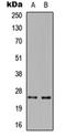 TNF Superfamily Member 14 antibody, orb304634, Biorbyt, Western Blot image 