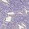 Alpha-2-Glycoprotein 1, Zinc-Binding antibody, NBP1-86842, Novus Biologicals, Immunohistochemistry paraffin image 