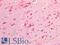 Platelet Derived Growth Factor Receptor Alpha antibody, LS-A10774, Lifespan Biosciences, Immunohistochemistry paraffin image 