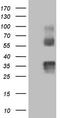 Protein C Receptor antibody, LS-C339679, Lifespan Biosciences, Western Blot image 