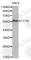 Cortactin antibody, A0841, ABclonal Technology, Western Blot image 