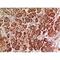 Heparanase antibody, LS-C387109, Lifespan Biosciences, Immunohistochemistry paraffin image 