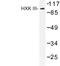 Hexokinase 3 antibody, LS-C177018, Lifespan Biosciences, Western Blot image 