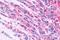 Neuromedin B Receptor antibody, NLS828, Novus Biologicals, Immunohistochemistry paraffin image 