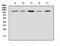 Heat Shock Protein Family H (Hsp110) Member 1 antibody, A04168, Boster Biological Technology, Western Blot image 