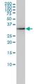 Aldo-Keto Reductase Family 7 Member A2 antibody, H00008574-M01, Novus Biologicals, Western Blot image 