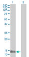 Macrophage Migration Inhibitory Factor antibody, LS-C104992, Lifespan Biosciences, Western Blot image 