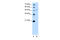 Spt1 antibody, ARP46721_P050, Aviva Systems Biology, Western Blot image 