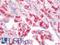 Hemoglobin Subunit Alpha 2 antibody, LS-B10549, Lifespan Biosciences, Immunohistochemistry paraffin image 