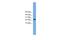 Chorionic somatomammotropin hormone antibody, A06795, Boster Biological Technology, Western Blot image 