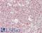 DNA Fragmentation Factor Subunit Alpha antibody, LS-B14742, Lifespan Biosciences, Immunohistochemistry paraffin image 