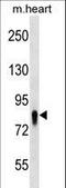 Ubiquitin-associated and SH3 domain-containing protein A antibody, LS-C157308, Lifespan Biosciences, Western Blot image 