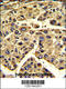 Eukaryotic Translation Initiation Factor 3 Subunit H antibody, 62-372, ProSci, Immunohistochemistry paraffin image 