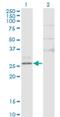 Chymotrypsinogen B1 antibody, H00001504-M02, Novus Biologicals, Western Blot image 