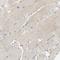 Cytochrome P450 Oxidoreductase antibody, NBP1-85357, Novus Biologicals, Immunohistochemistry paraffin image 