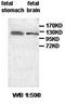 Apoptosis Associated Tyrosine Kinase antibody, orb77461, Biorbyt, Western Blot image 