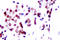 Signal Transducer And Activator Of Transcription 5A antibody, LS-C176222, Lifespan Biosciences, Immunohistochemistry paraffin image 