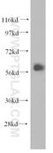Eukaryotic Translation Initiation Factor 2B Subunit Delta antibody, 11332-1-AP, Proteintech Group, Western Blot image 