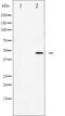 Jun Proto-Oncogene, AP-1 Transcription Factor Subunit antibody, abx012203, Abbexa, Western Blot image 