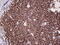 IKAROS Family Zinc Finger 3 antibody, M01611, Boster Biological Technology, Immunohistochemistry paraffin image 