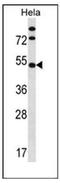 Inositol Hexakisphosphate Kinase 1 antibody, AP52220PU-N, Origene, Western Blot image 