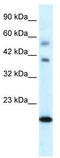 BolA-like protein 1 antibody, TA329894, Origene, Western Blot image 