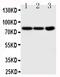 Neurotrophic Receptor Tyrosine Kinase 1 antibody, PA2149-1, Boster Biological Technology, Western Blot image 