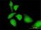 Transketolase Like 1 antibody, H00008277-M01, Novus Biologicals, Immunofluorescence image 