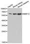 Matrix Metallopeptidase 13 antibody, MBS126939, MyBioSource, Western Blot image 