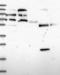 Ring Finger Protein 169 antibody, NBP2-13239, Novus Biologicals, Western Blot image 