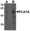 Phospholipase A1 Member A antibody, LS-B10189, Lifespan Biosciences, Western Blot image 