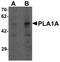 Phospholipase A1 member A antibody, LS-B10189, Lifespan Biosciences, Western Blot image 