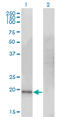Cysteine Dioxygenase Type 1 antibody, LS-C196889, Lifespan Biosciences, Western Blot image 