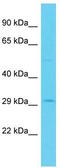 PAC2 antibody, TA331835, Origene, Western Blot image 