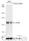 Ataxin 2 antibody, GTX130329, GeneTex, Western Blot image 